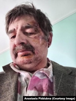 Вітчим Насті теж був поранений