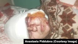 Мама Насті після авіаудару