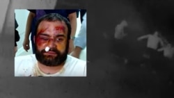 Violent Attacks Leave Opponents Of Georgian 'Foreign Agent' Bill Bloodied, Bruised, And Defiant  Violent Attacks Leave Opponents Of Georgian 'Foreign Agent' Bill Bloodied, Bruised, And Defiant