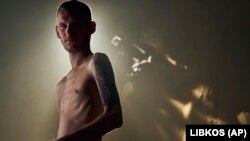 Дмитро Козацький «Орест», керівник пресслужби полку «Азов», фотограф і оборонець Маріуполя, показує своє виснажене тіло після перебування в російському полоні. Київ, 3 жовтня 2022 року