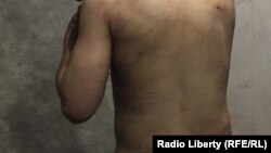 Кадр із запису скайпом. Сліди побиття у полоні. Харків, 25 березня 2022 року