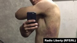 Олексія захопили і утримували без води і їжі російські окупанти на Харківщині. Били і на його очах били інших