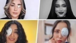 گزارش رادیو فردا از چشمهایی که هدف گلوله قرار گرفتند  گزارش رادیو فردا از چشمهایی که هدف گلوله قرار گرفتند