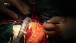 Яка ціна нерозвиненої трансплантології в Україні? (відео) Яка ціна нерозвиненої трансплантології в Україні? (відео)