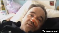 Андрей Петков бо бинии шикастааш