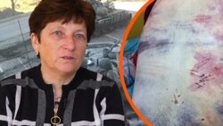 «Розкажеш, хто чим дихає»: російські військові катували старосту села на Луганщині «Розкажеш, хто чим дихає»: російські військові катували старосту села на Луганщині