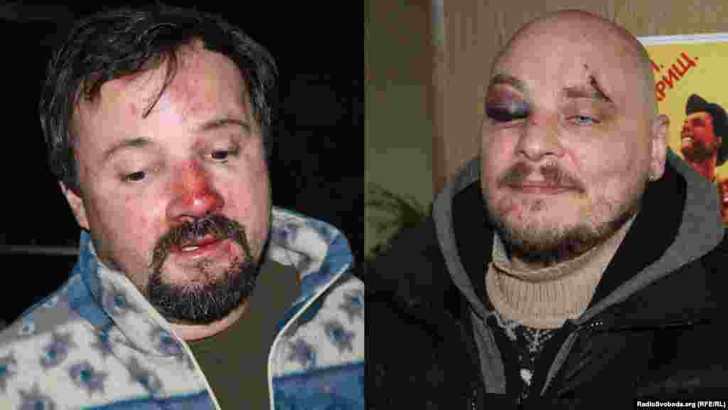 Революція гідності. Київ, 20 січня 2014 року. На комбінованому фото співробітники Радіо Свобода Iгор Ісхаков  (ліворуч) і Дмитро Баркар, які були затримані та побиті «беркутівцями» під час ведення прямої трансляції з вулиці Грушевського. Радіо Свобода вело прямі трансляції з першого дня Революції гідності, 21 листопада 2013 року