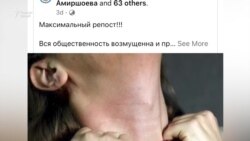 Мадина 70 рӯз боз беҳуш аст Мадина 70 рӯз боз беҳуш аст