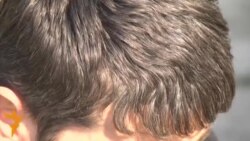 Чаро мӯи сар дар ҷавонӣ сафед мешавад? Чаро мӯи сар дар ҷавонӣ сафед мешавад?