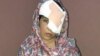 Afghan Teen Loses Her Eye Waiting To Prove Horrific Injury Was From War