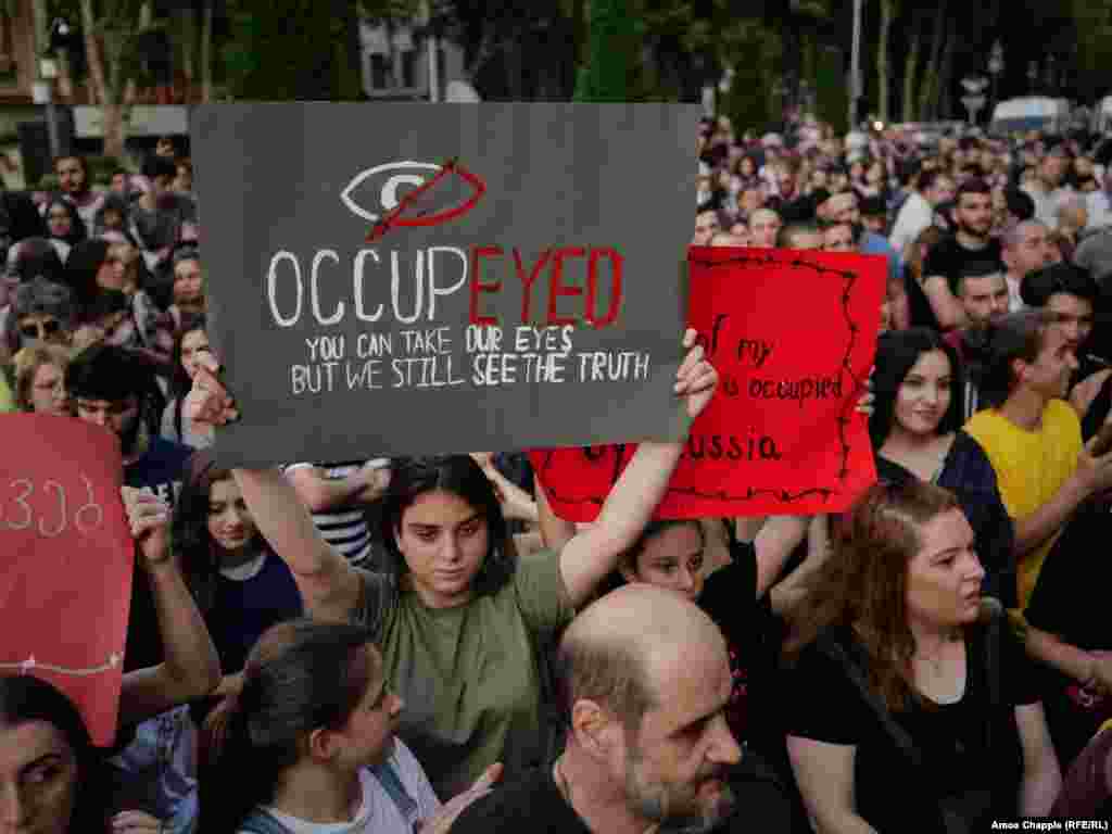 A protester holds a sign in reference to demonstrators who lost their eyes in violence or were temporarily blinded by tear gas during clashes with police on June 20. Police used rubber bullets and tear gas against the crowd, with hundreds of people being injured, including many police.  
