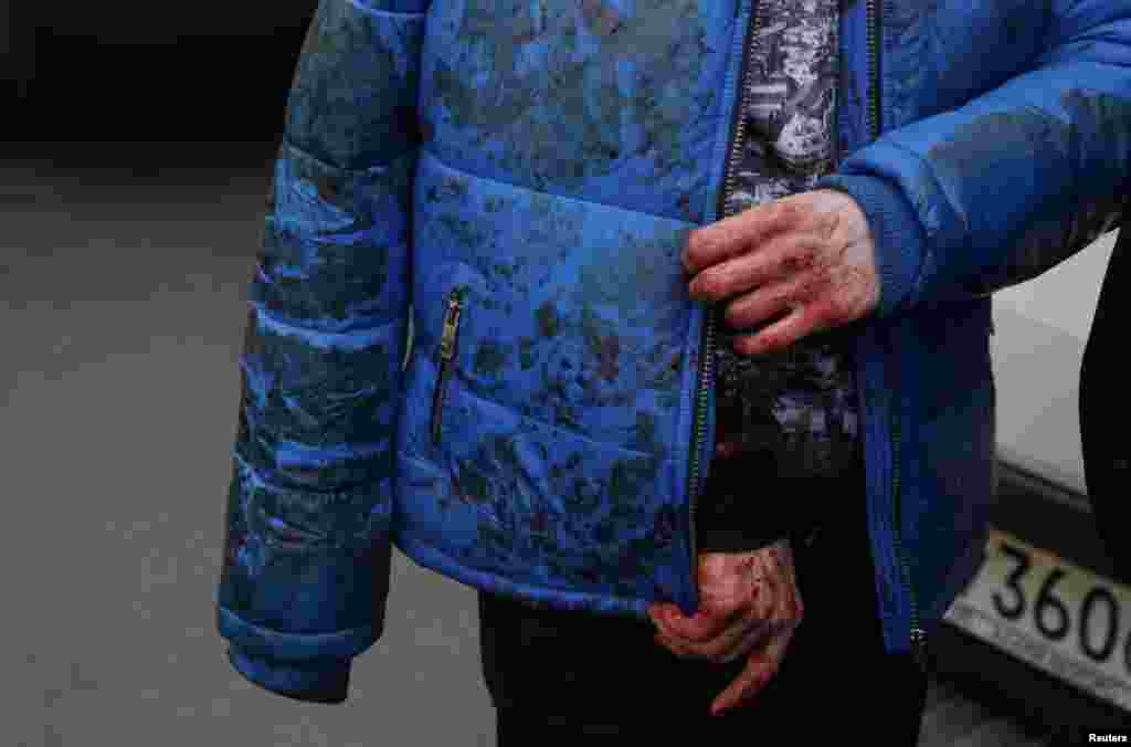An injured person seen outside the Sennaya Ploshchad subway station. 